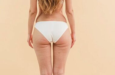 11 Melhores óleos essenciais para a celulite [Testado e aprovado]